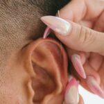 Acupuncture : utile pour apaiser les acouphènes ?